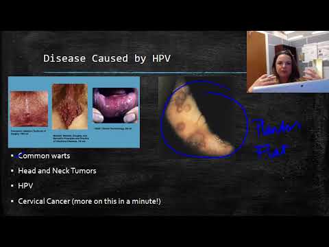 hpv vírus priznaky típusú belfergek