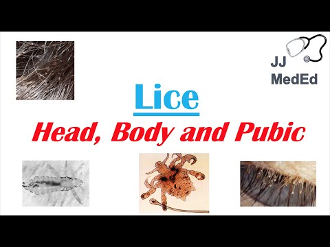 Lice (Head, Body and Pubic Lice) | Pediculosis | Species, Symptoms and Treatment