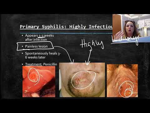 Treponema pallidum Syphilis