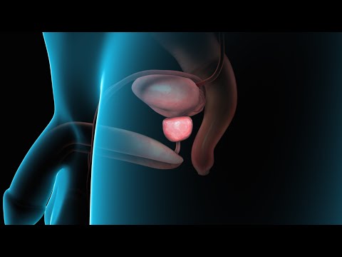 Enlarged Prostate (BPH)