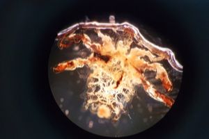 Voš lonová (Phthirus pubis) - detail parazita 